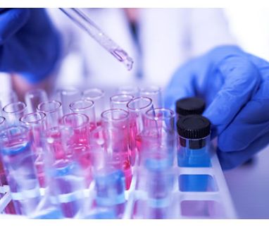 In Canton Ticino al via uno studio sullo sviluppo dell’epidemia di Covid-19. IBSA dona i test sierologici che serviranno per la raccolta dati.