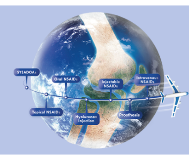 IBSA expands its product portfolio for the osteoarticular area
