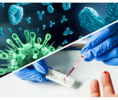 Results of the COVID-19 seroprevalence study